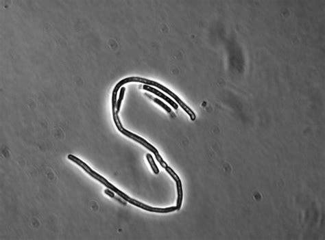 Bacillus Cereus Image Eurekalert Science News Releases