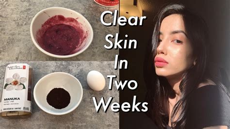Best Diy Face Masks For Clear Skin These Really Work Youtube