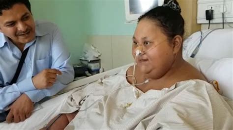 Egypt 500kg Woman Loses Half Her Weight After Surgery