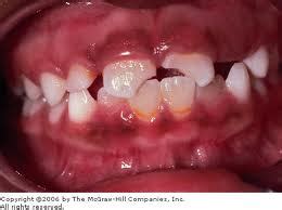 Dental Trauma | Collapse Medicine | Doom and Bloom (TM ...