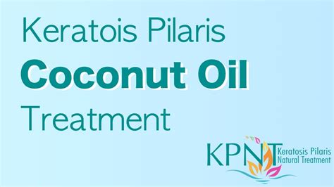 Keratosis Pilaris Coconut Oil Treatment Video Youtube