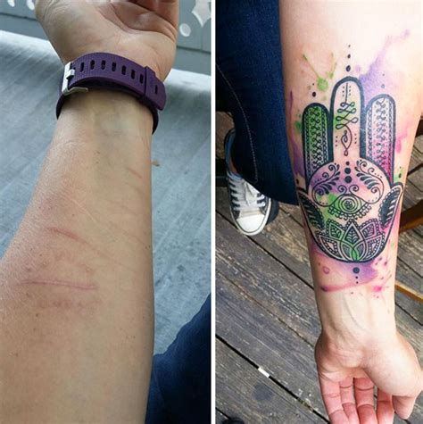 210 Amazing Tattoos That Turn Scars Into Works Of Art