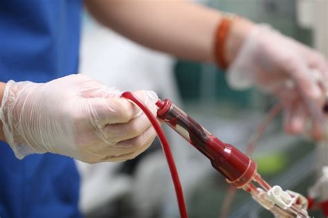 Red Blood Cell Transfusion Not Independent Risk Factor For Thrombosis