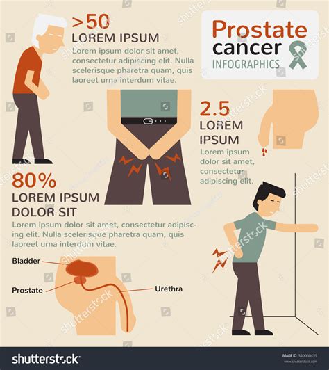 Prostate Cancer Infographics Stock Vector 340060439 Shutterstock