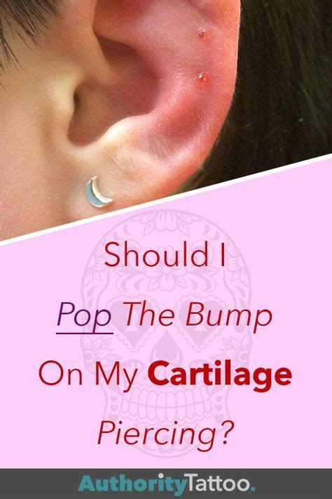 A Bump On The Cartilage Piercing May Be Displeasing Aesthetically But Shouldnt Be Popped