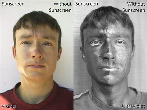 Sunscreen 101 Dermatology Answers