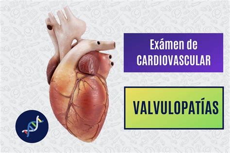 Cardiovascular Valvulopatías Paradigmia