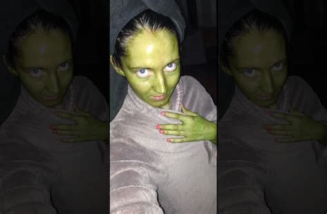 This Woman S Complexion Turns Green After Using Expired Tanning Lotion
