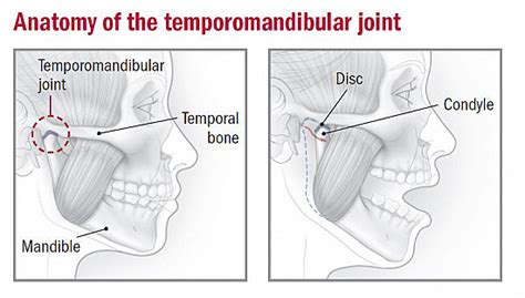 Temporomandibular Joint Dysfunction Harvard Health
