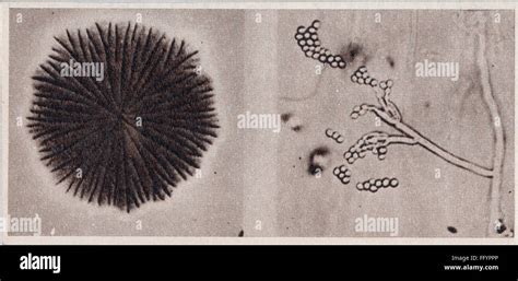 Hongo Penicillium Notatum Fotograf As E Im Genes De Alta Resoluci N Alamy The Best Porn