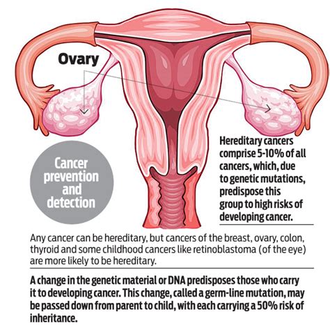For ovarian cancer, these include family history and age. Like Angelina Jolie, 75 women got their ovaries removed in ...