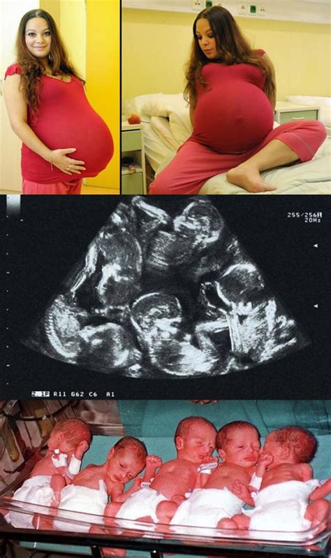 Alexandra Kinova Gave Birth To Naturally Conceived Quintuplets In June Heres Her Scan P