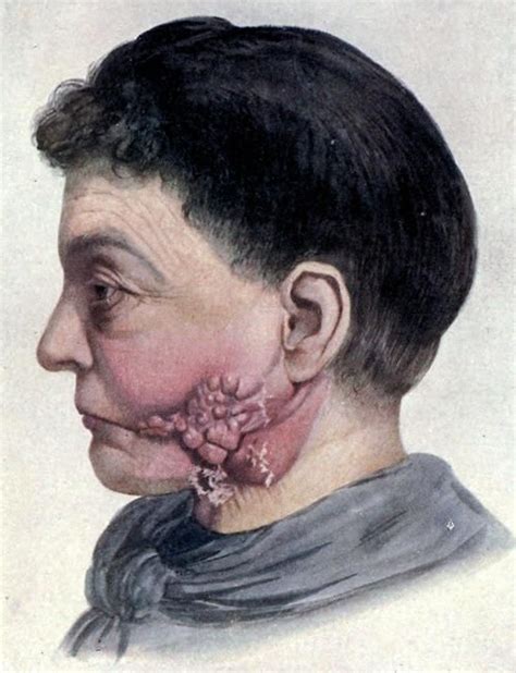 eve echoes cyclone face tank solo t7 anomalies,scout or inquisitor. 56 best medical anomaly images on Pinterest | Med school ...