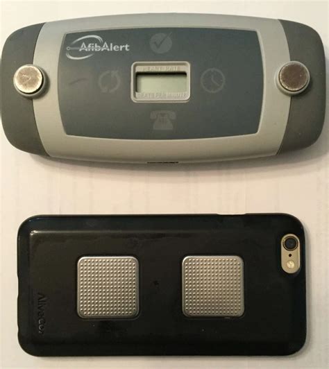Afibalert Versus Alivecorkardia Which Mobile Ecg Device Is Best At Accurately Identifying