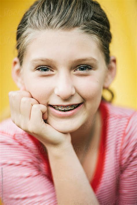 Portrait Of Pre Teen Girl With Braces On Her Teeth Del Colaborador De