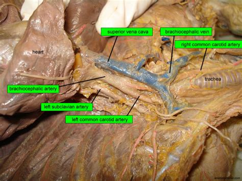 What do you mean by the term dlapedesls? Major Arteries and Veins of the Cat | Anatomy Corner