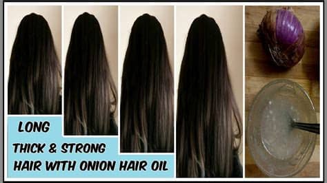 #blackseeds are also known as black caraway, black cumin, kalonji, and black onion seeds. Onion Hair Oil - Fast Hair Regrowth, Hair Loss, Long ...