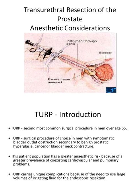 Transurethral Resection Of The Prostate Anesthetic Considerations Dr