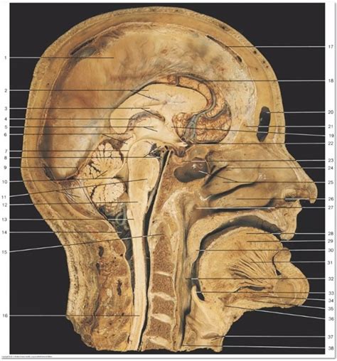 Brain Practical Median Sagittal Section Through The Head And Neck