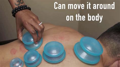 Edge Cupping Therapy Set By Lure Essentials Benefits Of Cupping And How To Diy Cupping At Home