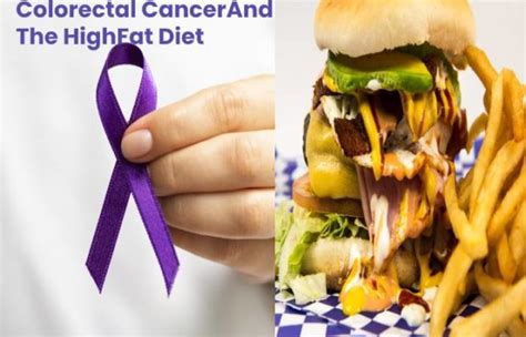 High Fat Diet And Risk Of Colorectal Cancer Being Natural Human