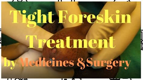 What Is TIGHT FORESKIN TREATMENT With Circumcision Surgery DR KUBER