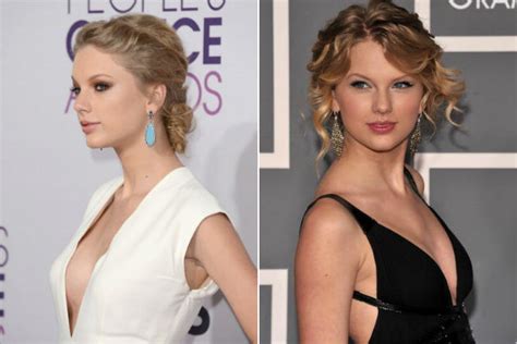 Taylor Swift Before And After Breast Implants And Plastic Surgery