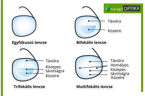 Multifokális szemüveg jelentése használata és megszokása