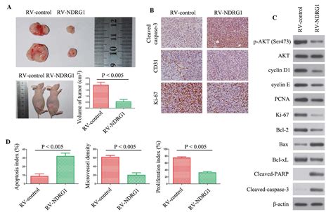overexpression of n‑myc downstream‑regulated gene 1 inhibits human glioma proliferation and