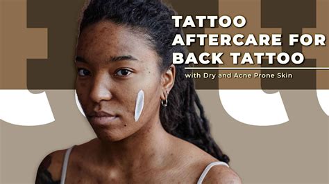 Tattoos And Acne What You Need To Know Before Getting Inked