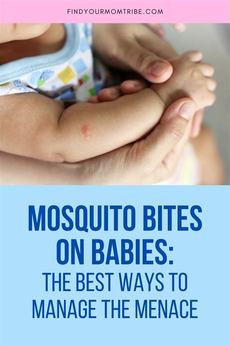 80 Best Of How To Treat Mosquito Bites On Babies Insectza