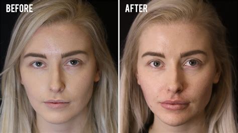 How To Fix Asymmetrical Face Naturally