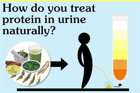 How Do You Treat Protein In Urine Naturally? | Kidney treatment, Care ...