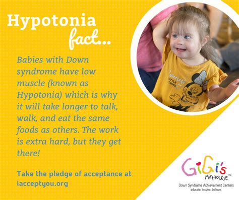 Hypotonia Down Syndrome
