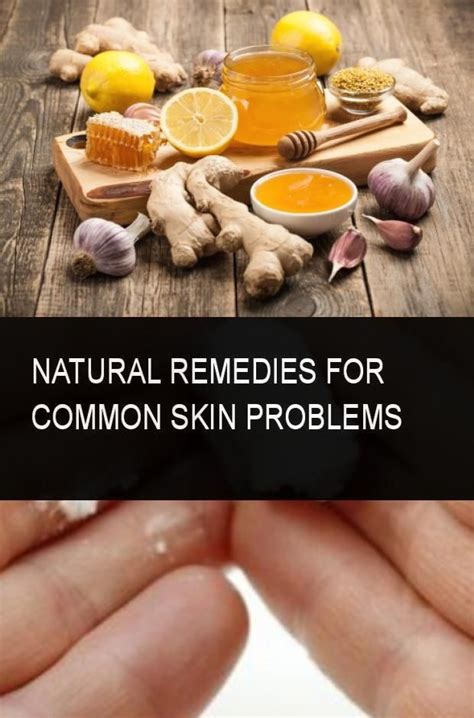 Natural Remedies For Common Skin Problems Natural Remedies Skin