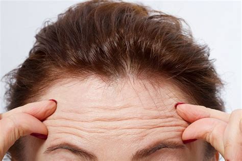 What Forehead Wrinkles Might Tell You About Your Heart Health Live