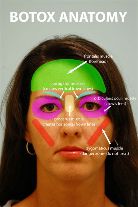 Botox Tutorial Dallas Facial Smoothing Info Plano