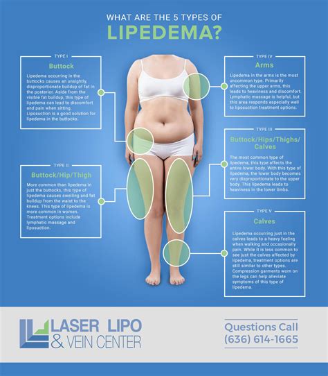 St Louis Lipedema Liposuction Treatment Laser Lipo And Vein Center