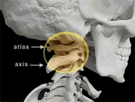 The atlas is the first cervical vertebra and articulates with the occiput of the head and the axis (c2). What is Upper Cervical? : Yellow Wood Chiropractic