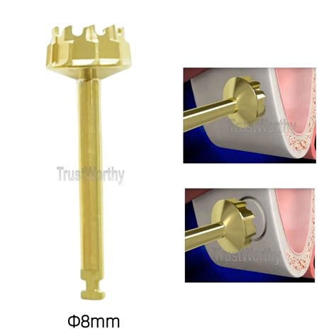 8mm Dental Gear Cutter Drills Lateral Approach Sinus Lift Implant Burs