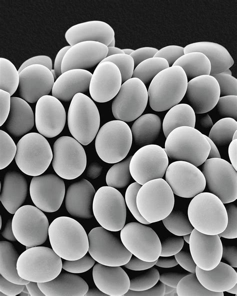 Chaetomium Globosum Spores Photograph By Dennis Kunkel Microscopy