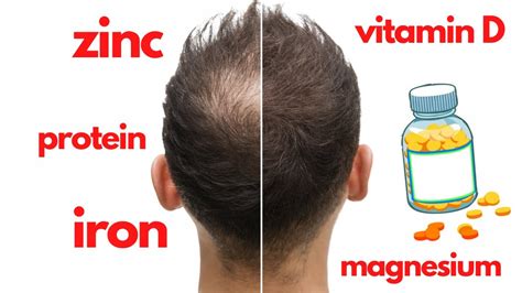 The Best Hair Vitamins That Actually Work 7 Vitamins That Can Make
