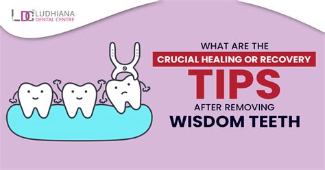 What Are The Crucial Healing Or Recovery Tips After Removing Wisdom Teeth
