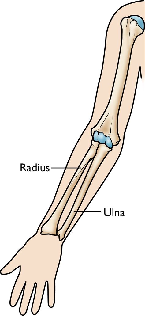 The radius bone is this bone here and it lies laterally in the anatomical position. Forearm Fractures in Children - Types and Treatments ...