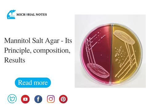 Mannitol Salt Agar Its Principle Composition Results