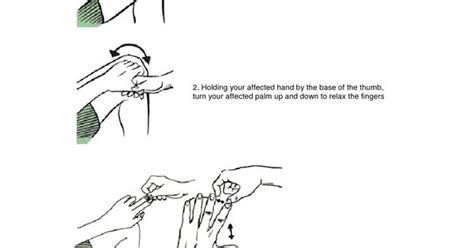 Pictures Of Exercises For Stroke Patients Hand Exercises For A Stroke Patient Therapy