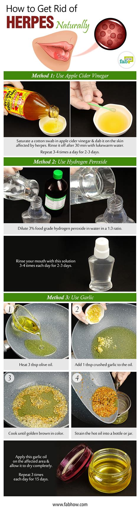 Let's find out how to get rid of herpes. How to Get Rid of Herpes Naturally (Kill the Virus and ...