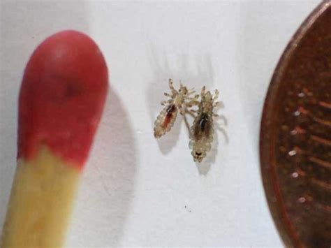 Pubic Lice Bites Pictures