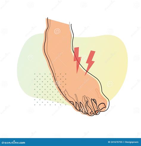 Twisted Foot Ankle Sprain Illustration Stock Vector Illustration
