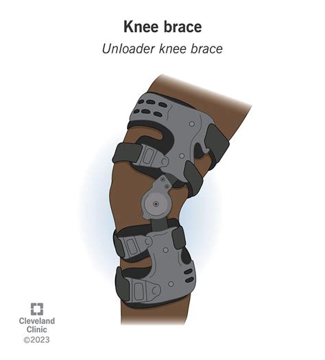 Knee Braces What They Do And How To Wear One